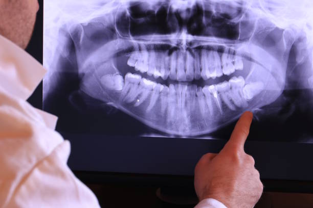 Best Pediatric Emergency Dentist in Worthington Hills, KY