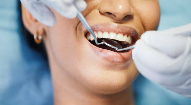 Best Urgent Care for Lost Fillings or Crowns in Worthington Hills, KY